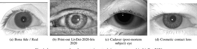 Figure 1 for Synthetic Periocular Iris PAI from a Small Set of Near-Infrared-Images