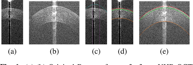 Figure 1 for Learning to Segment Corneal Tissue Interfaces in OCT Images