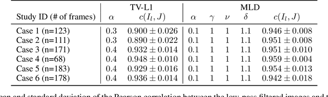 Figure 4 for Noise-specific denoising method with applications to high-frequency ultrasonic images