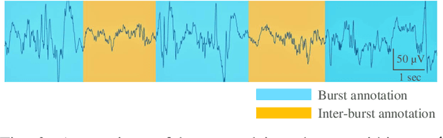 Figure 2 for Identifying trace alternant activity in neonatal EEG using an inter-burst detection approach