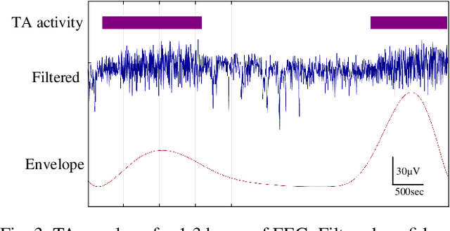 Figure 3 for Identifying trace alternant activity in neonatal EEG using an inter-burst detection approach