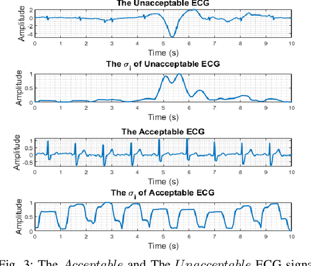 Figure 3 for Energy-Efficient Real-Time Heart Monitoring on Edge-Fog-Cloud Internet-of-Medical-Things