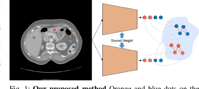 Figure 1 for Voxel-level Siamese Representation Learning for Abdominal Multi-Organ Segmentation