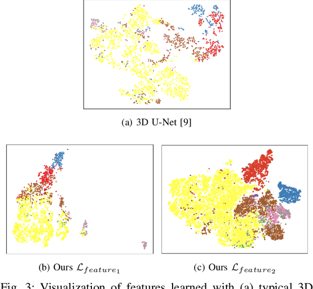 Figure 3 for Voxel-level Siamese Representation Learning for Abdominal Multi-Organ Segmentation