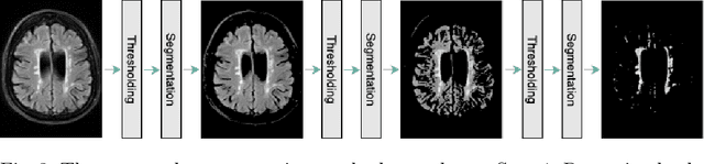 Figure 3 for Dementia Severity Classification under Small Sample Size and Weak Supervision in Thick Slice MRI