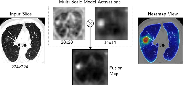 Figure 3 for Coronavirus Detection and Analysis on Chest CT with Deep Learning