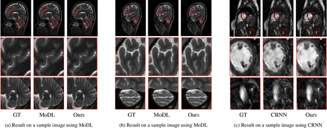 Figure 3 for Overcoming Measurement Inconsistency in Deep Learning for Linear Inverse Problems: Applications in Medical Imaging