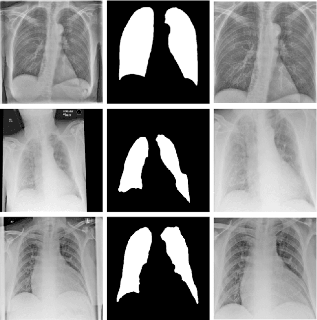 Figure 2 for Optimising Chest X-Rays for Image Analysis by Identifying and Removing Confounding Factors