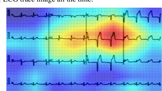 Figure 3 for COV-ECGNET: COVID-19 detection using ECG trace images with deep convolutional neural network