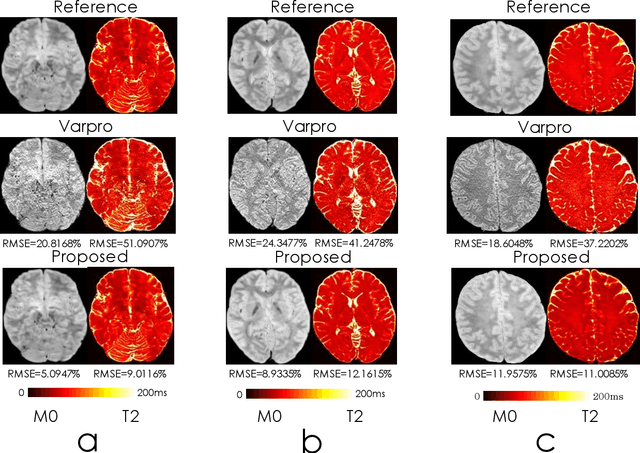 Figure 2 for Accurate parameter estimation using scan-specific unsupervised deep learning for relaxometry and MR fingerprinting