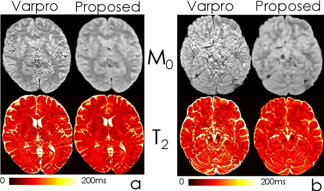 Figure 3 for Accurate parameter estimation using scan-specific unsupervised deep learning for relaxometry and MR fingerprinting