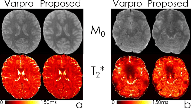 Figure 4 for Accurate parameter estimation using scan-specific unsupervised deep learning for relaxometry and MR fingerprinting