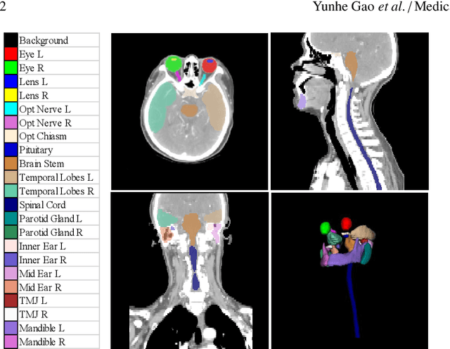 Figure 1 for FocusNetv2: Imbalanced Large and Small Organ Segmentation with Adversarial Shape Constraint for Head and Neck CT Images