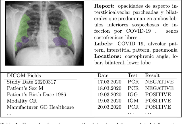 Figure 1 for BIMCV COVID-19+: a large annotated dataset of RX and CT images from COVID-19 patients