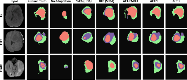 Figure 3 for ACT: Semi-supervised Domain-adaptive Medical Image Segmentation with Asymmetric Co-training