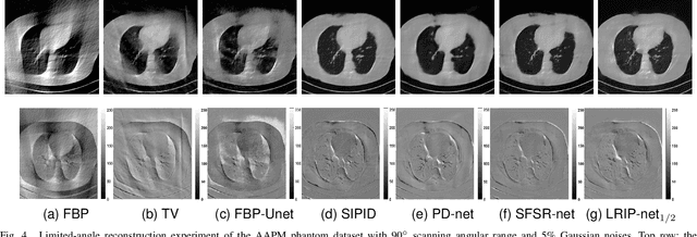 Figure 4 for LRIP-Net: Low-Resolution Image Prior based Network for Limited-Angle CT Reconstruction