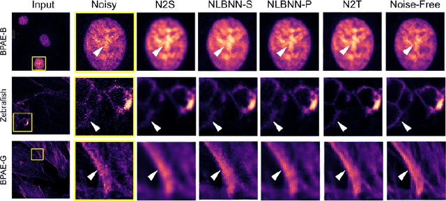 Figure 3 for Patch-based Non-Local Bayesian Networks for Blind Confocal Microscopy Denoising
