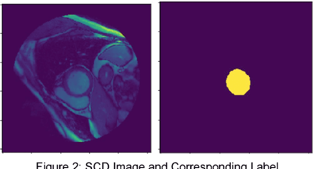 Figure 2 for Left Ventricle Segmentation and Volume Estimation on Cardiac MRI using Deep Learning