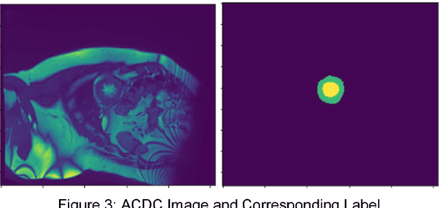 Figure 4 for Left Ventricle Segmentation and Volume Estimation on Cardiac MRI using Deep Learning