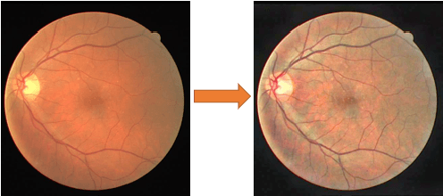 Figure 2 for Transfer Learning Through Weighted Loss Function and Group Normalization for Vessel Segmentation from Retinal Images
