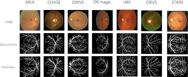 Figure 3 for Transfer Learning Through Weighted Loss Function and Group Normalization for Vessel Segmentation from Retinal Images