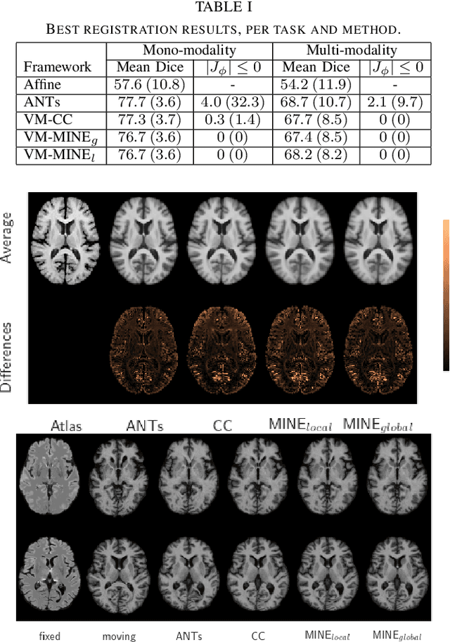 Figure 4 for Mutual information neural estimation for unsupervised multi-modal registration of brain images