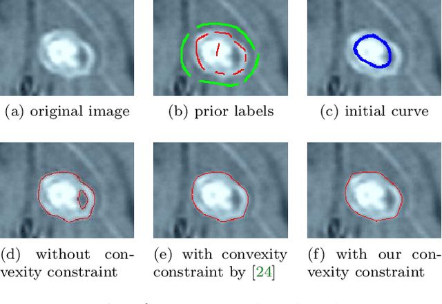 Figure 1 for A level set representation method for N-dimensional convex shape and applications