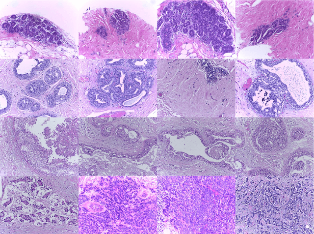 Figure 3 for Deep weakly-supervised learning methods for classification and localization in histology images: a survey
