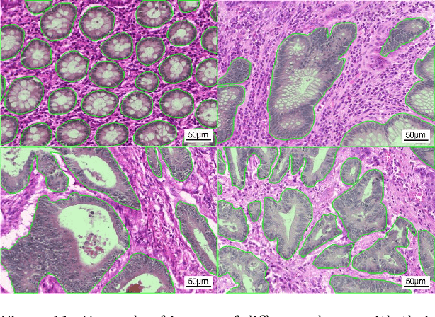 Figure 4 for Deep weakly-supervised learning methods for classification and localization in histology images: a survey