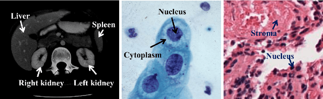 Figure 1 for Deep weakly-supervised learning methods for classification and localization in histology images: a survey