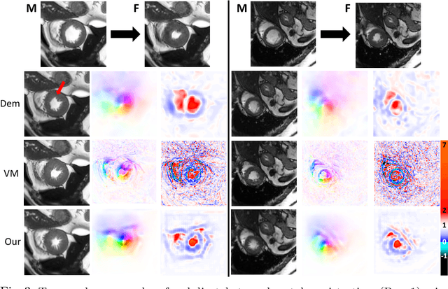 Figure 3 for Unsupervised Probabilistic Deformation Modeling for Robust Diffeomorphic Registration