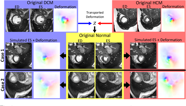 Figure 4 for Unsupervised Probabilistic Deformation Modeling for Robust Diffeomorphic Registration