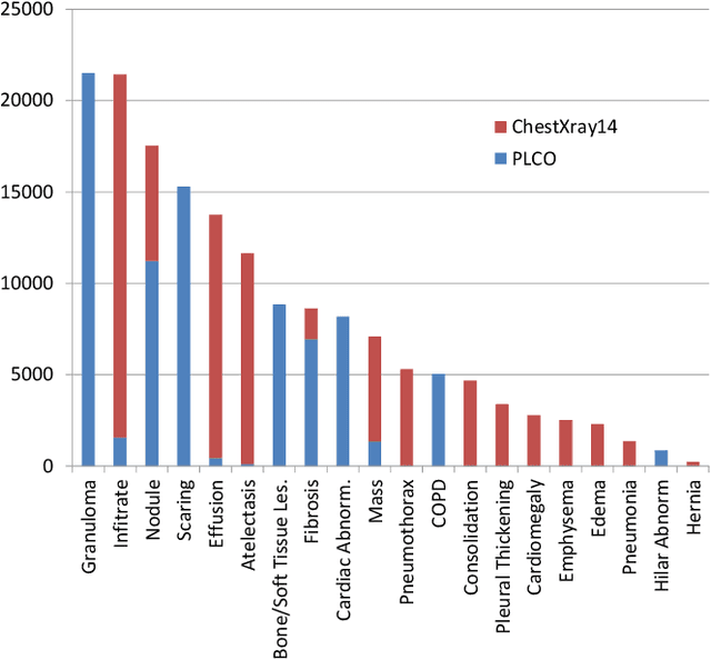 Figure 3 for Multi-task Learning for Chest X-ray Abnormality Classification on Noisy Labels