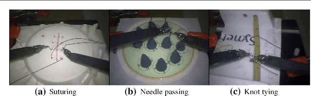 Figure 3 for Video-based surgical skill assessment using 3D convolutional neural networks