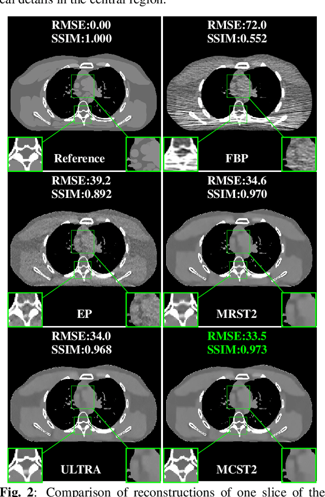 Figure 2 for Two-layer clustering-based sparsifying transform learning for low-dose CT reconstruction