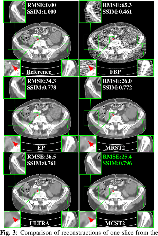 Figure 3 for Two-layer clustering-based sparsifying transform learning for low-dose CT reconstruction