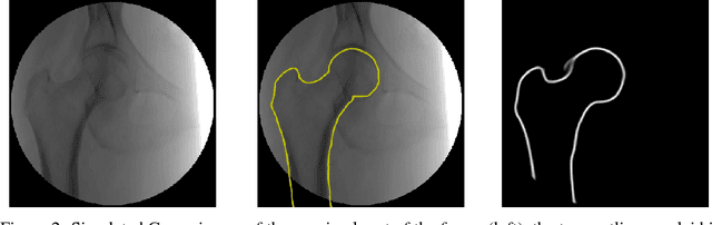 Figure 2 for Deep Morphing: Detecting bone structures in fluoroscopic X-ray images with prior knowledge