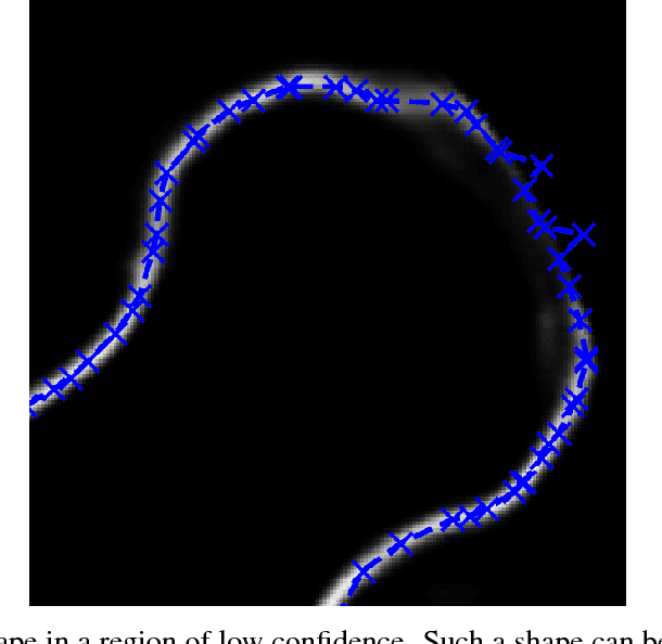 Figure 4 for Deep Morphing: Detecting bone structures in fluoroscopic X-ray images with prior knowledge