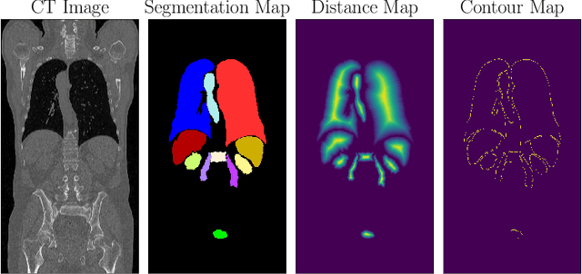 Figure 1 for Shape-Aware Complementary-Task Learning for Multi-Organ Segmentation