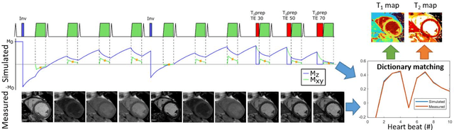 Figure 1 for Cartesian dictionary-based native T1 and T2 mapping of the myocardium