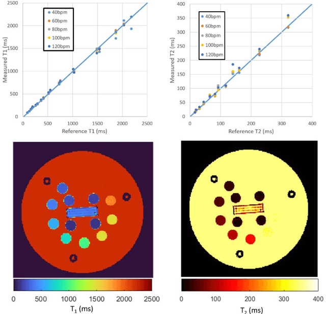 Figure 2 for Cartesian dictionary-based native T1 and T2 mapping of the myocardium