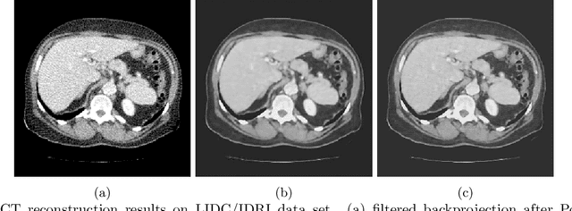 Figure 2 for TextureWGAN: Texture Preserving WGAN with MLE Regularizer for Inverse Problems