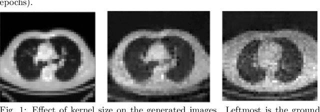 Figure 1 for Capturing Variabilities from Computed Tomography Images with Generative Adversarial Networks