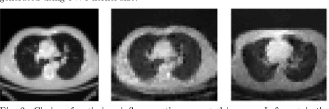 Figure 2 for Capturing Variabilities from Computed Tomography Images with Generative Adversarial Networks