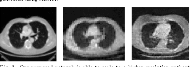 Figure 3 for Capturing Variabilities from Computed Tomography Images with Generative Adversarial Networks