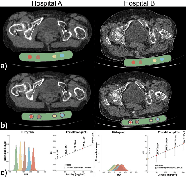 Figure 4 for Automated segmentation of an intensity calibration phantom in clinical CT images using a convolutional neural network