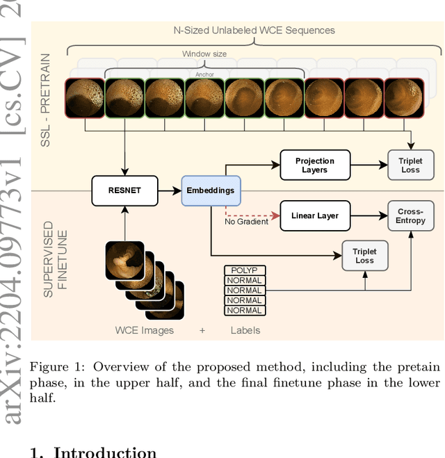 Figure 1 for Time-based Self-supervised Learning for Wireless Capsule Endoscopy
