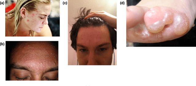 Figure 3 for TrueImage: A Machine Learning Algorithm to Improve the Quality of Telehealth Photos