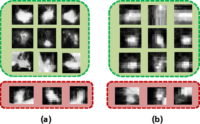 Figure 4 for TumorNet: Lung Nodule Characterization Using Multi-View Convolutional Neural Network with Gaussian Process