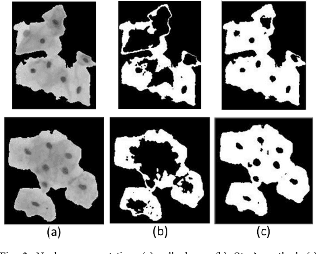 Figure 2 for Unsupervised Segmentation of Overlapping Cervical Cell Cytoplasm